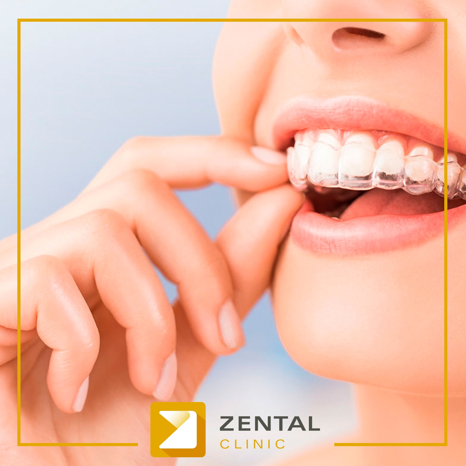 Clinica dental Zental Clinic – Zental Clinic – Centro Dental de Excelencia  en Majadahonda, Madrid.