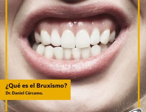 ¿Qué es el Bruxismo? 7 de cada 10 personas son bruxistas.