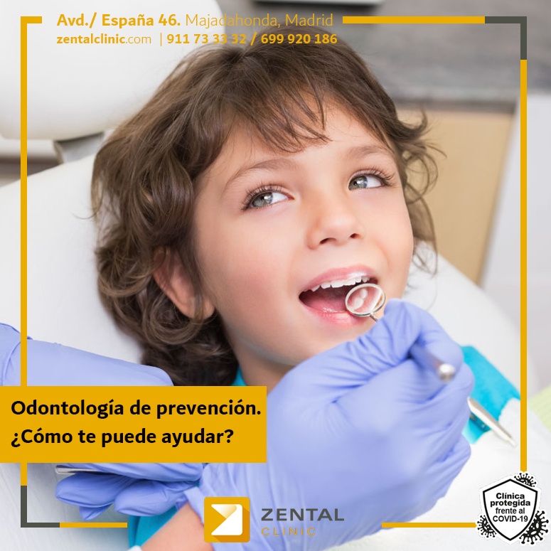 ¿qué Es La Odontología Preventiva Y Cómo Puede Ayudarte Zental Clinic Centro Dental Deemk 9486