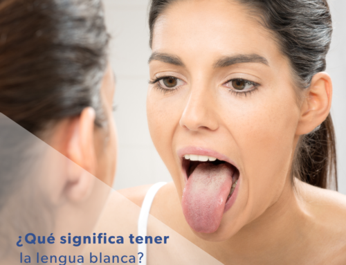 ¿Qué significa tener la lengua blanca?